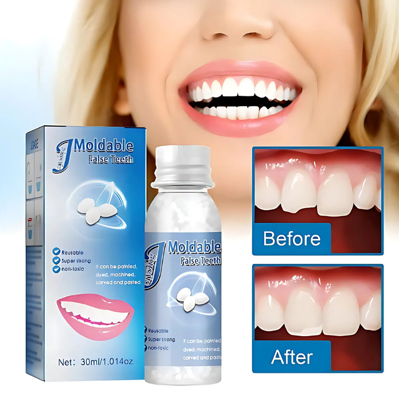 TeethRepair™ 1+1 GRATIS: Natürlich Aussehendes Zahne Reparaturset