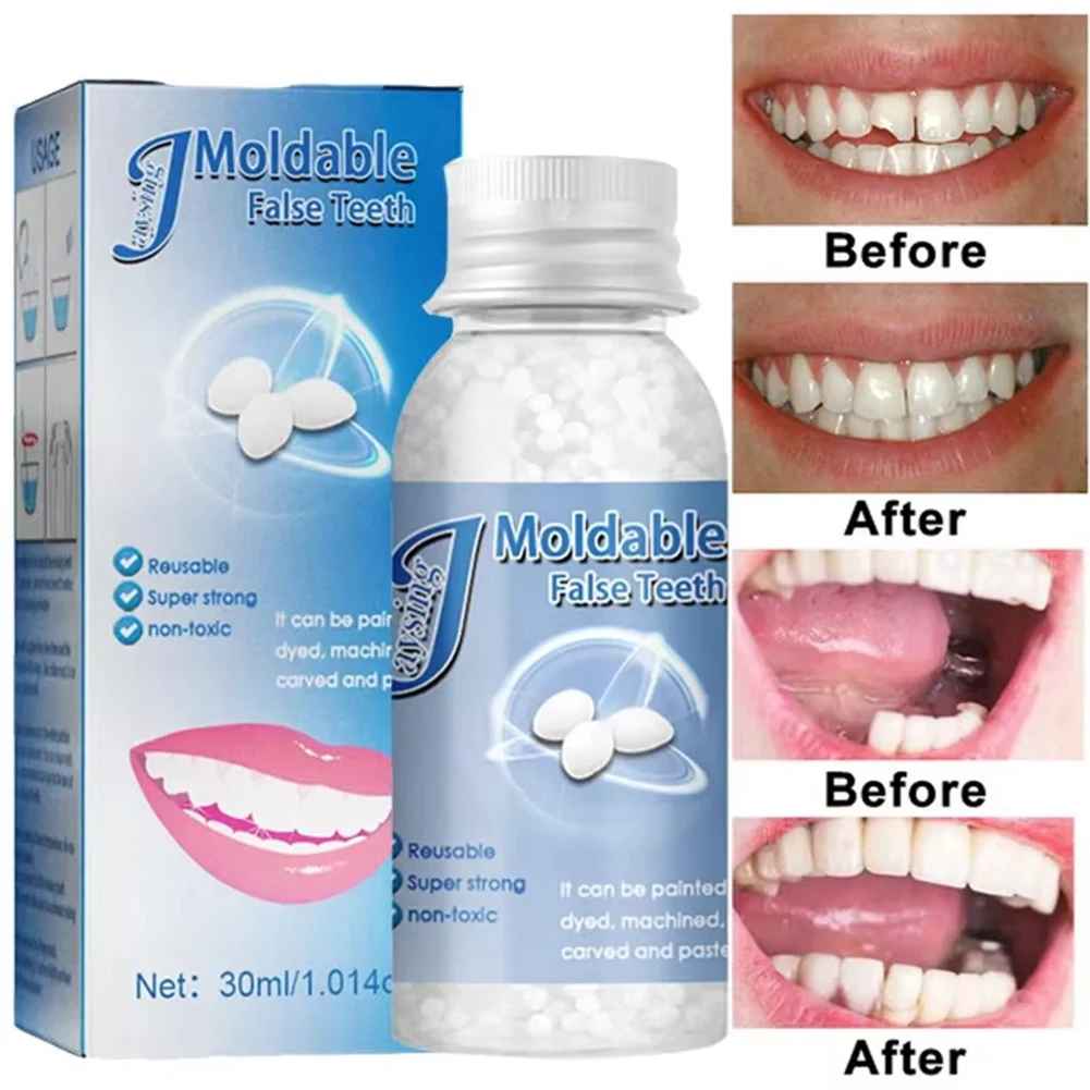 TeethRepair™ 1+1 GRATIS: Natürlich Aussehendes Zahne Reparaturset