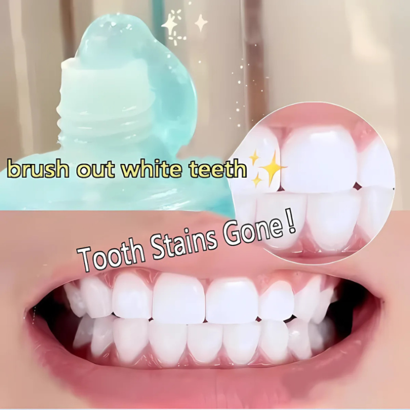 WhiteningToothpaste 1+1 GRATIS: Niacinamid Aufhellende Und Fleckenentfernende Zahnpasta