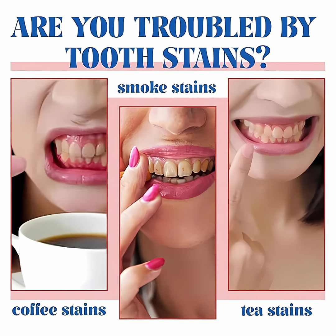 ProbioticToothpaste 1+1 GRATIS: Sanfte Zahnaufhellung Stärkende Probiotische Zahnpasta