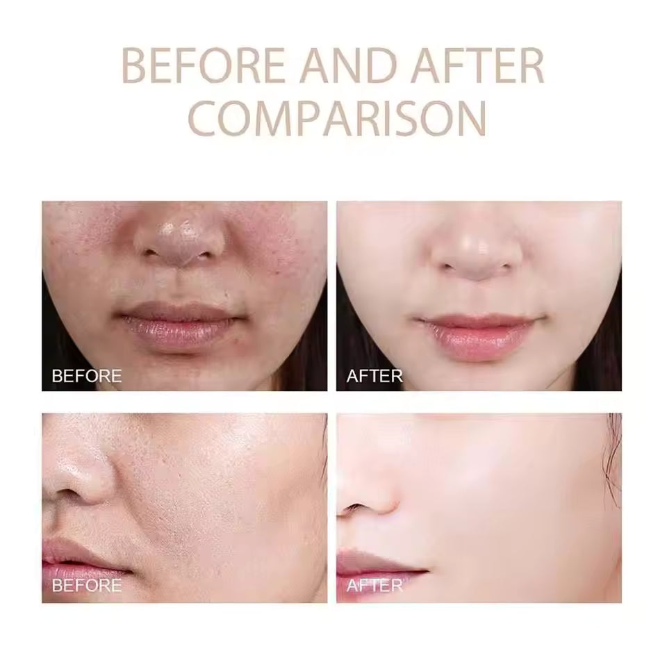 ExfoliatingSerum 1+1 GRATIS: Einfach Zu Bedienen Exfoliating-Ampulle Für Empfindliche Haut